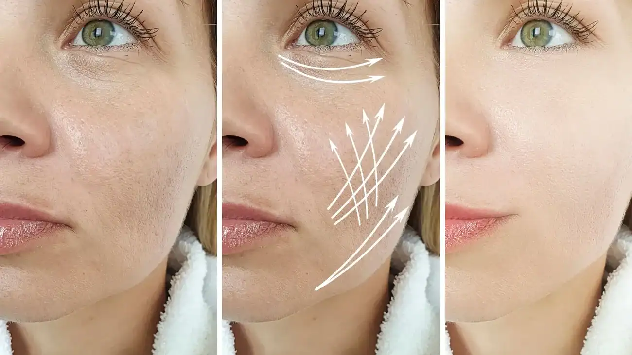 Can One Treatment Really Tackle More Than One Skin Concern Leigh on Sea?