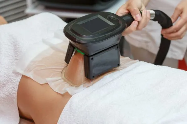 Image of person having fat freezing treatment to help weight gain Leigh on Sea