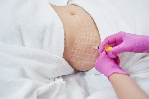 image of fat dissolving injections on love handles to help combat weight gain Leigh on Sea