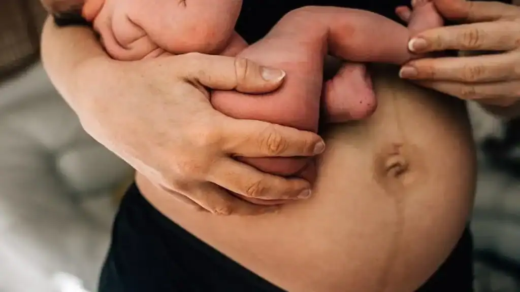 Why Is My Stomach Still Big After Pregnancy Leigh on Sea?