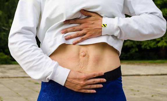 When Could Diastasis Recti Be the Missing Piece of the Puzzle Leigh on Sea?